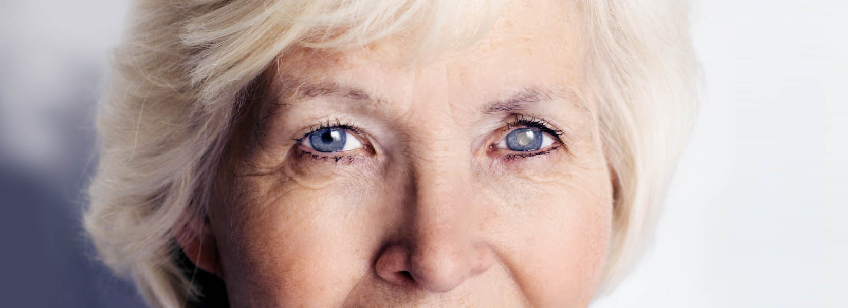 Cataract Surgery in Owosso